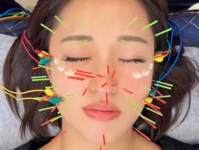Cocona101 in Makati: Japanese Acupuncture Clinic for Health & Beauty