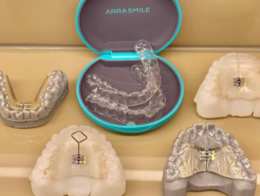 ArraSmile PH in Mandaluyong: Bringing Japan’s Trusted Mouthpiece Orthodontics to You